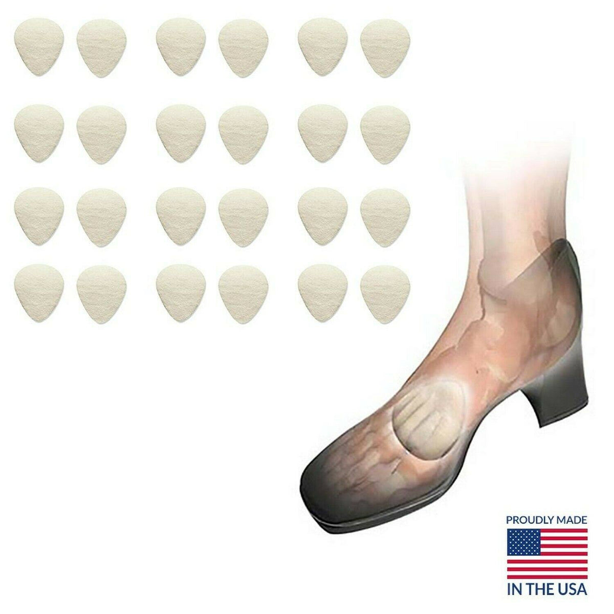 Metatarsal Cookies, 5/16 inch, Case of 12 Pairs F166